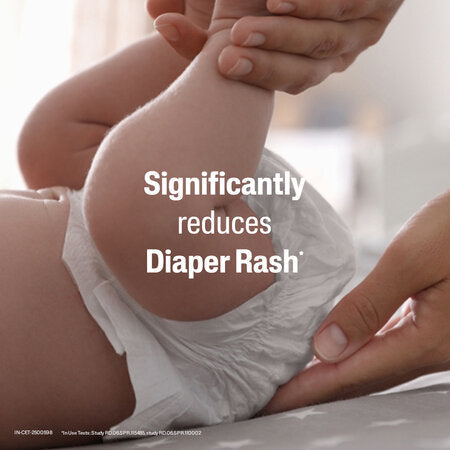 Baby's bottom in a diaper with a hand holding it, text 'Significantly reduces Diaper Rash' overlayed. Cetaphil Baby Diaper Rash Cream 70g go littles product main image 6